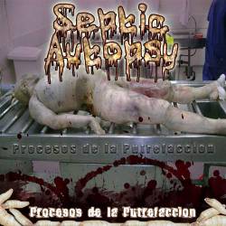 Septic Autopsy : Procesos de la Putrefaccion